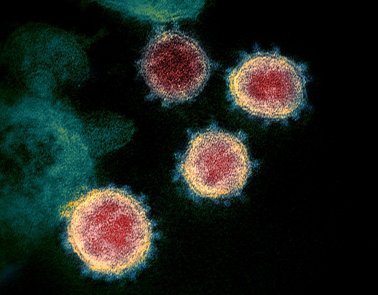768px-Novel_Coronavirus_SARS-CoV-2